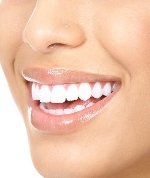 Cosmetic Dentistry in Bel Air MD 