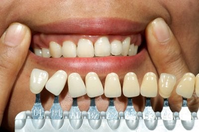 Dental Implants In Bel Air, MD