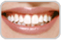 White Smile